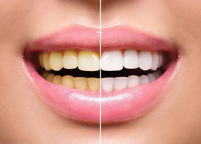 Teeth & Oral Care